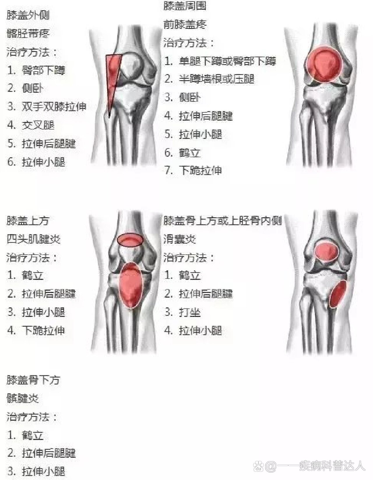 双侧膝关节疼痛图片