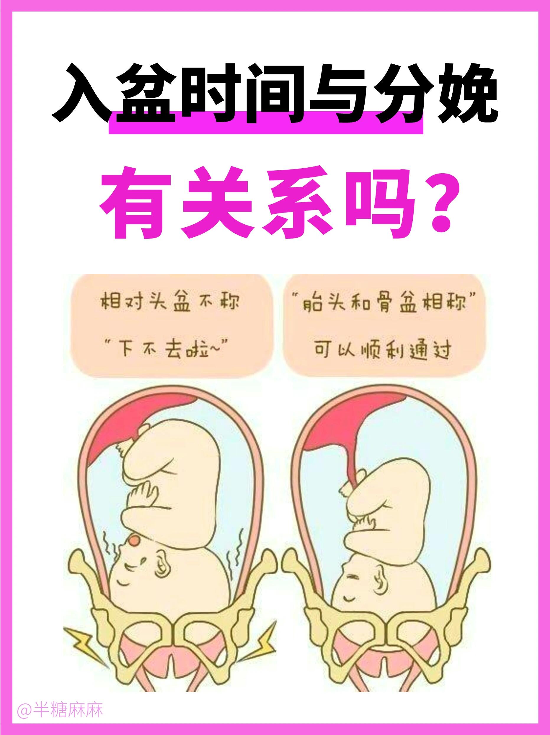 入盆时间与分娩有关系吗?