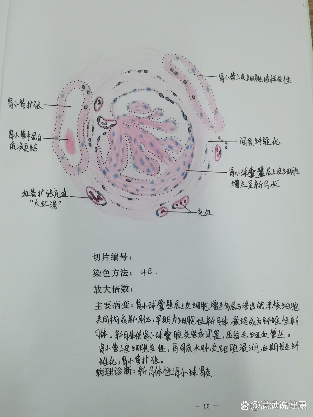 单核细胞画图图片