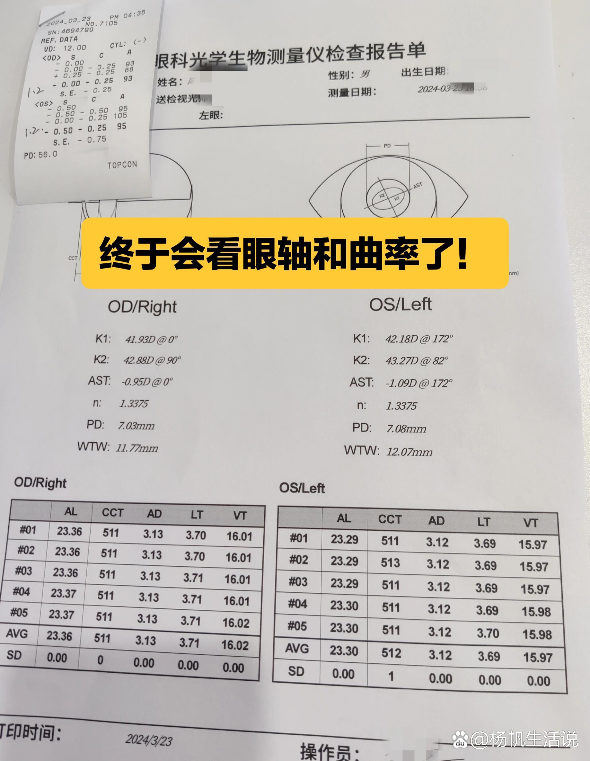 终于看懂眼轴和曲率的检查报告了