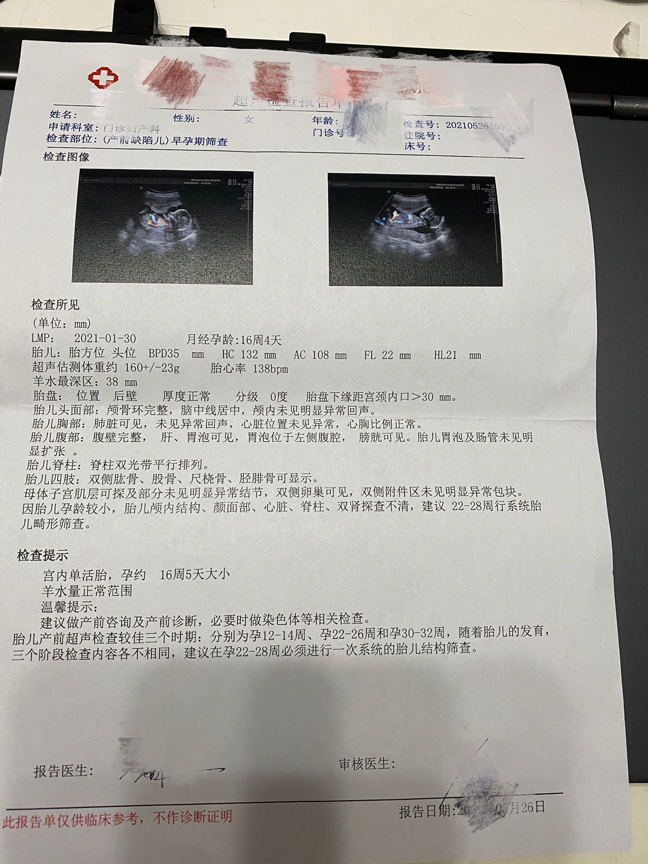 【产检4】孕16周,b超!