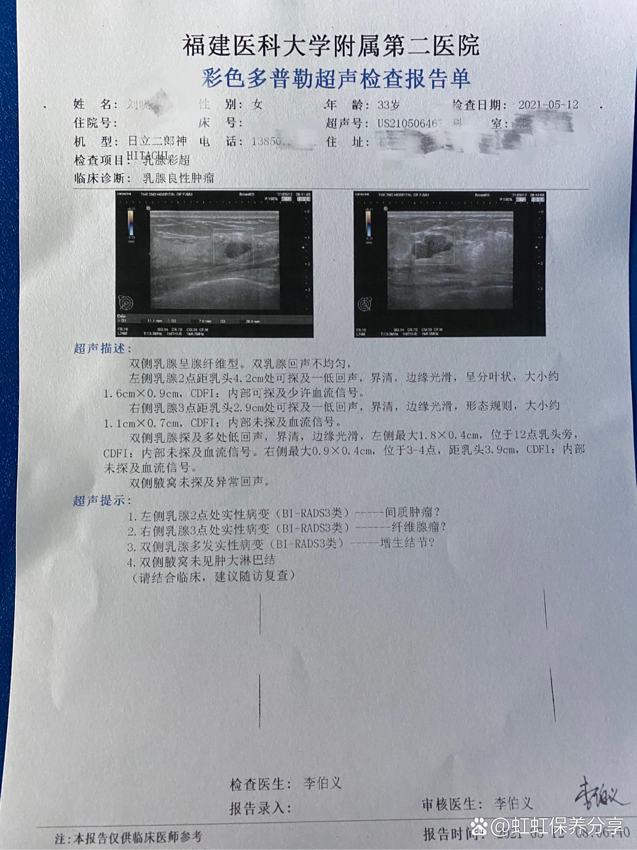 乳腺分叶状肿瘤
