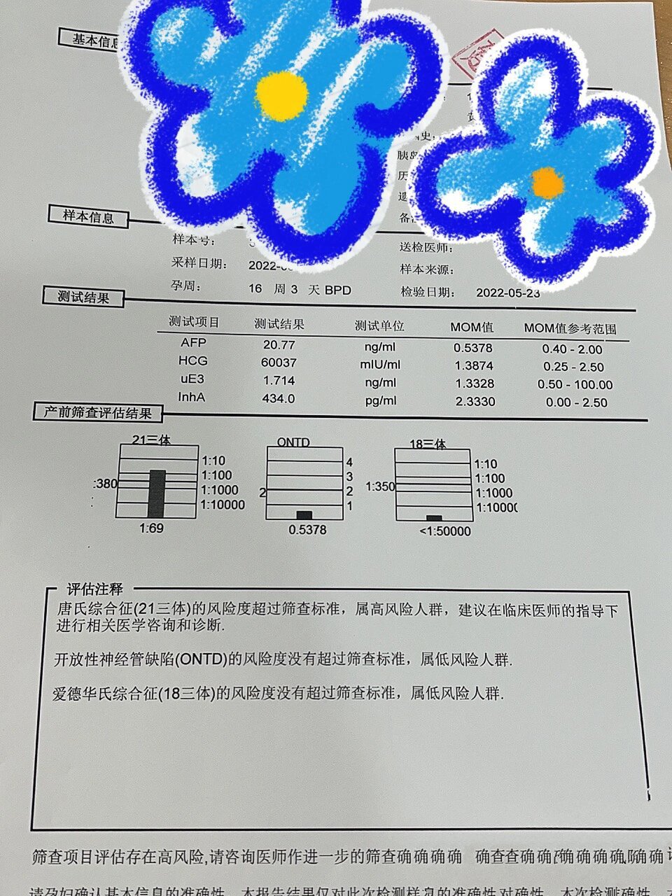 唐氏21三体高风险,羊水穿刺顺利翻盘【上】