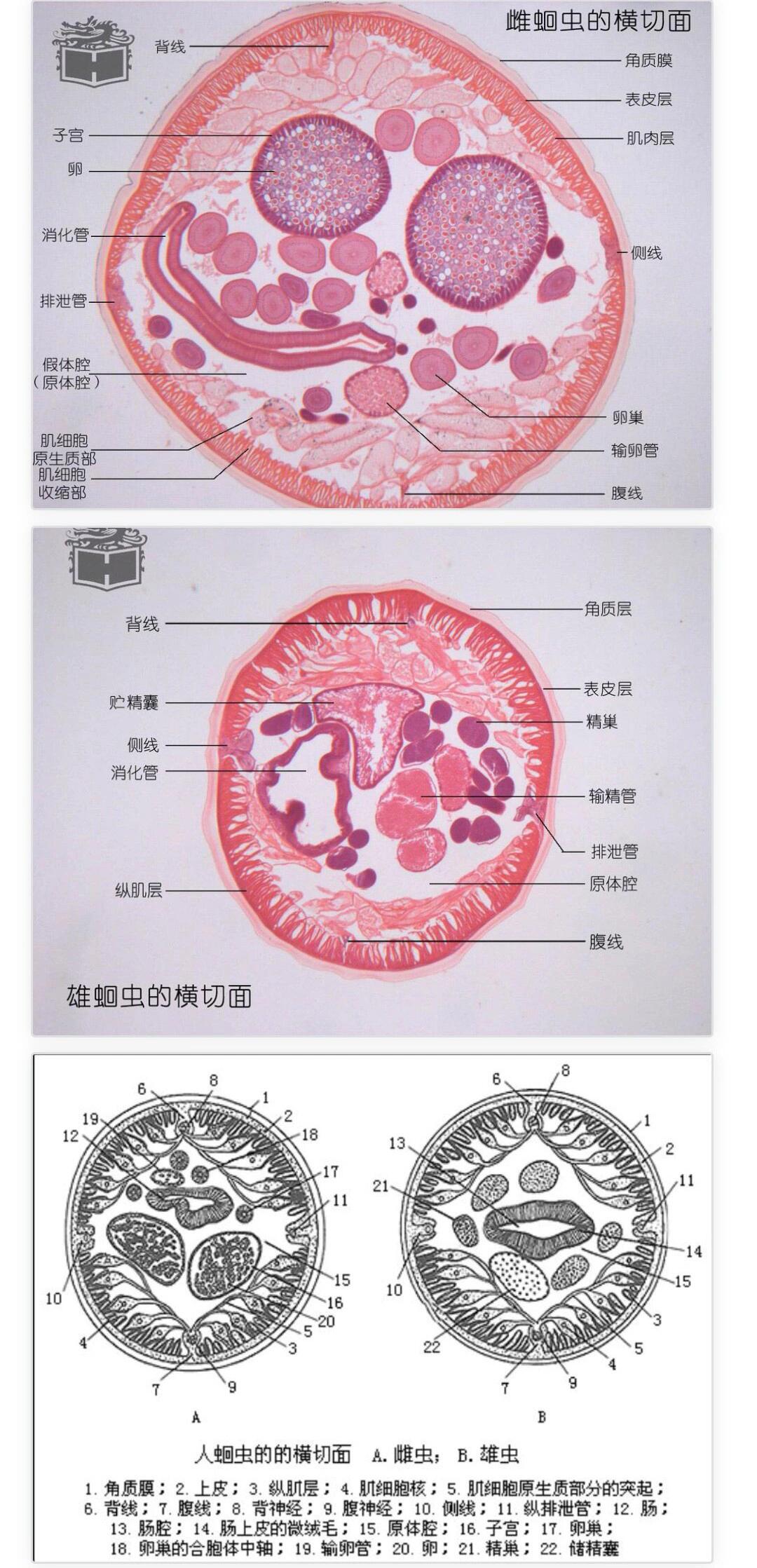 蛔虫的结构简图图片