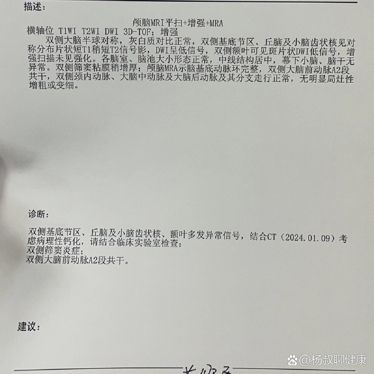 有宝贝们了解脑钙化灶吗