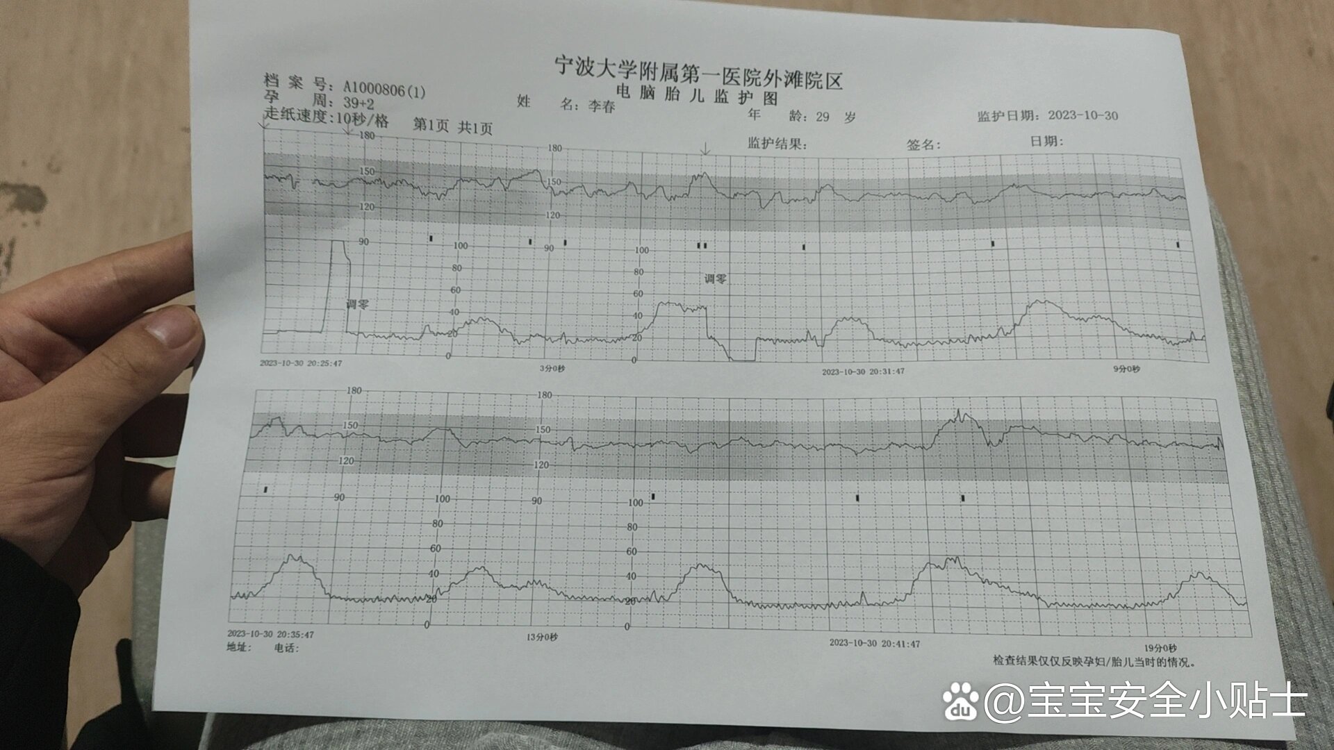 宫缩图怎么看图片