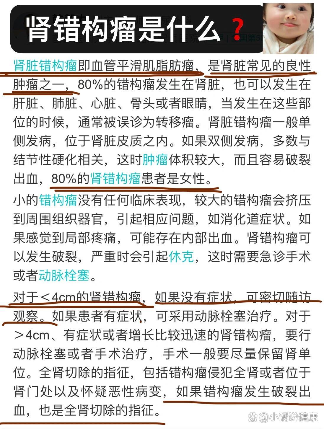 错构瘤是什么意思图片