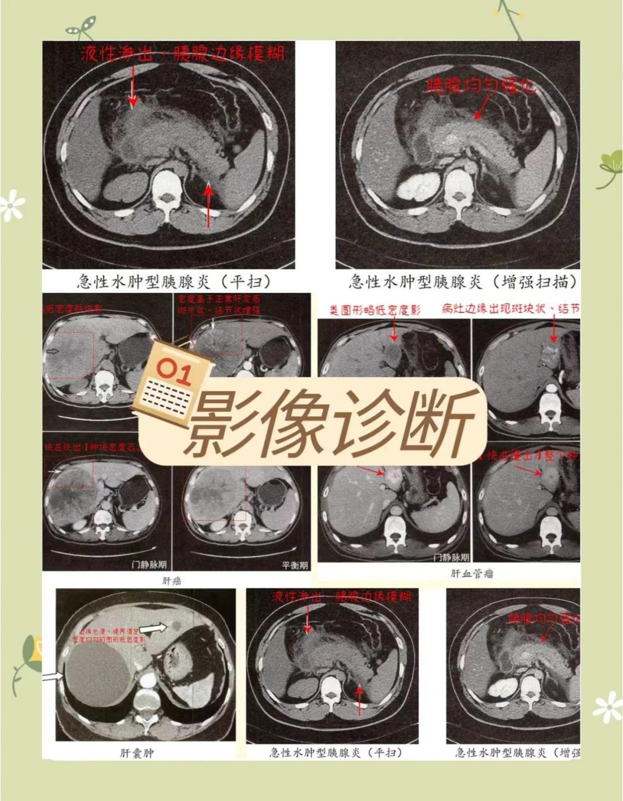 CT扫描秘籍：窗宽窗位