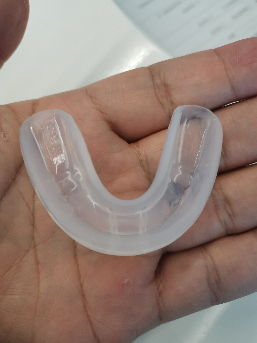 eta早期矫正小朋友换牙的时候牙齿不整齐,第一次佩戴eta定制