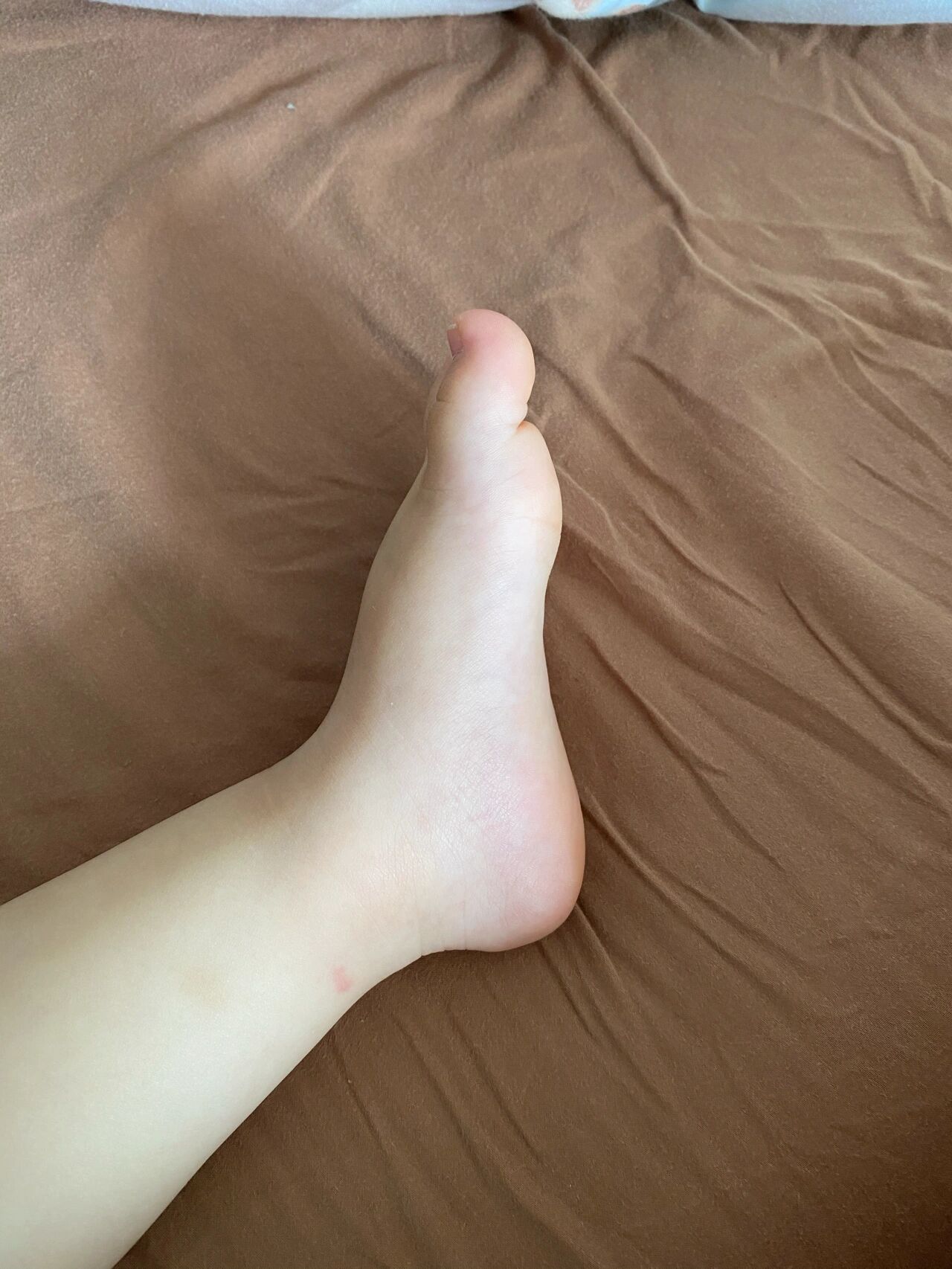 这样子是扁平足吗