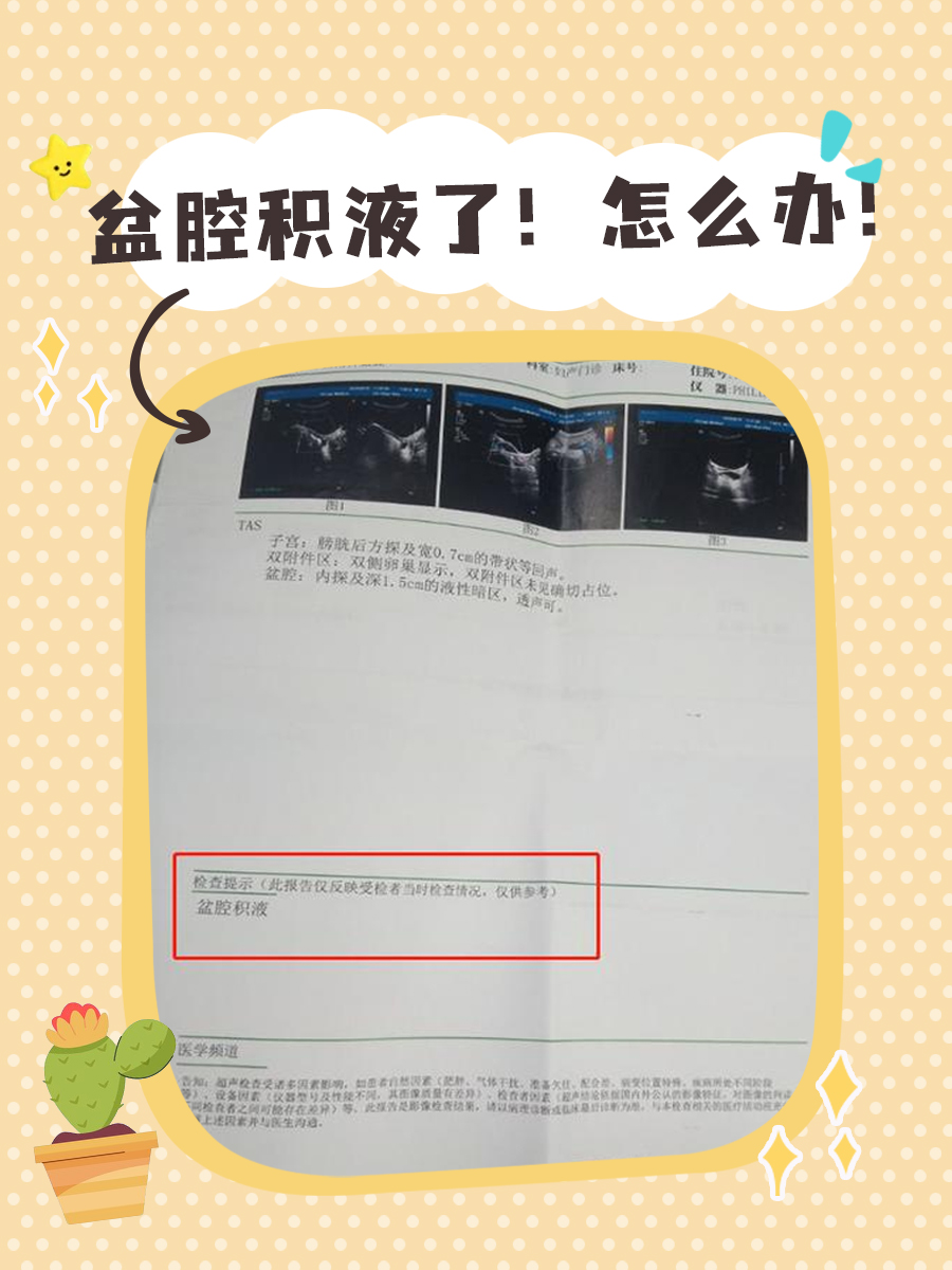 分享|盆腔积液怎么调理,看这一篇就够了!