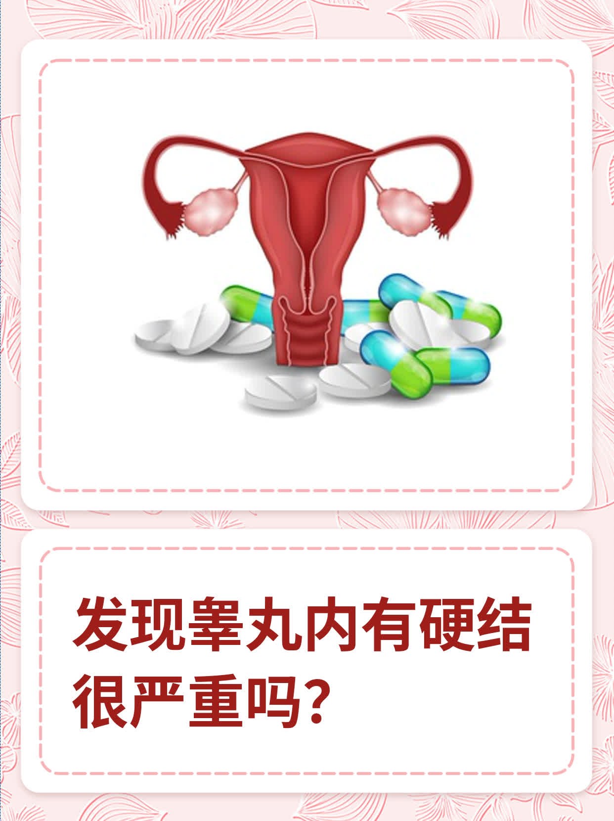 发现睾丸内有硬结很严重吗