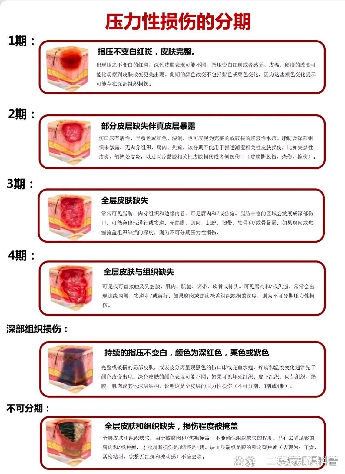 压疮分期图片