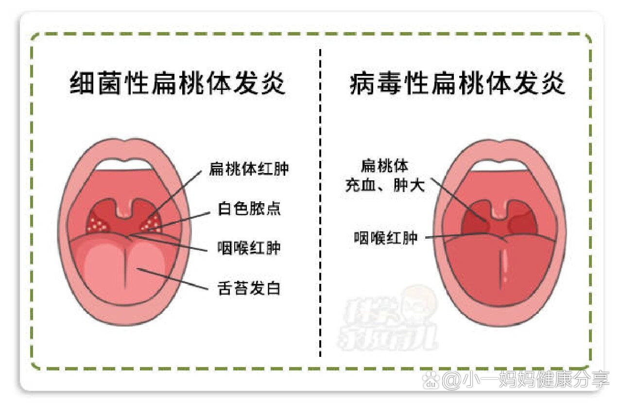 扁桃照片图片