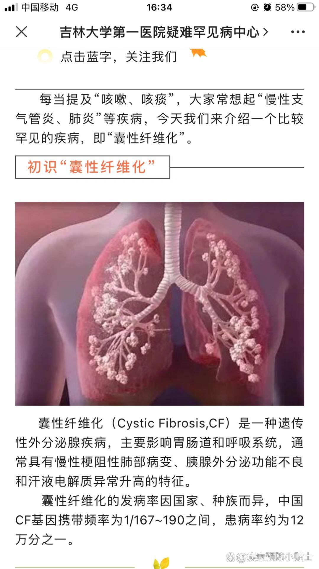 囊性纤维