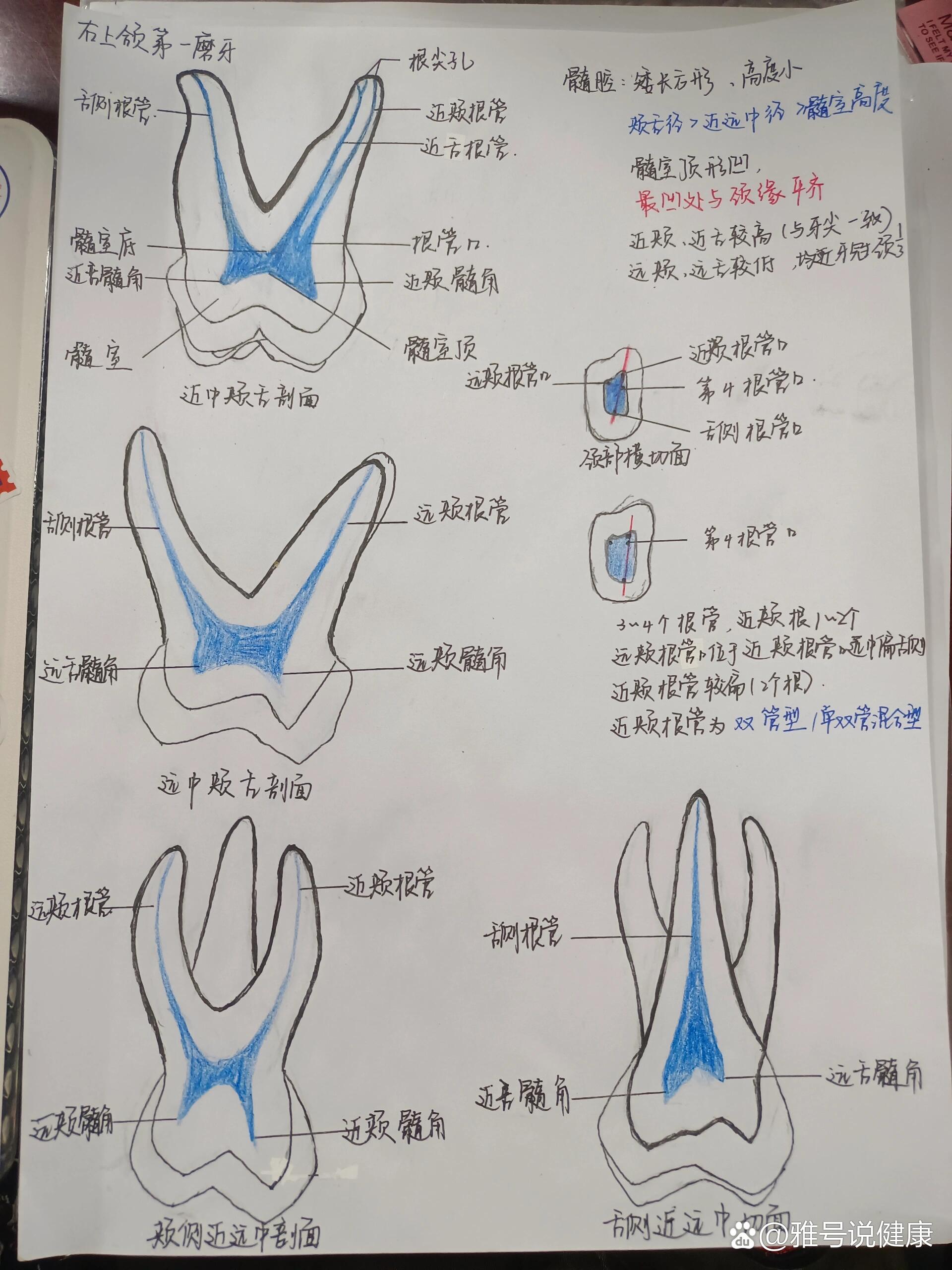 p 牙髓腔解剖 br 手绘上下6牙髓解剖图