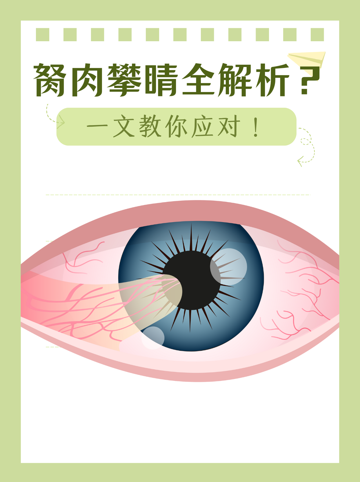 胬肉攀睛全解析?一文教你应对!
