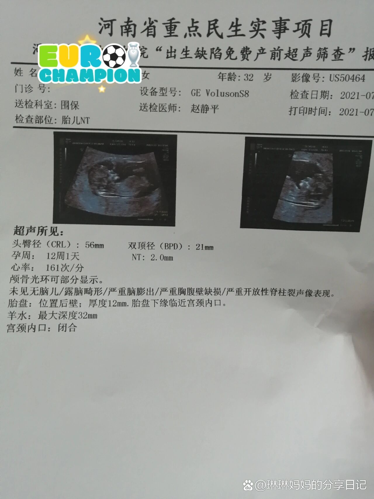 给翻倍不好,孕囊小胎芽大的姐妹正能量