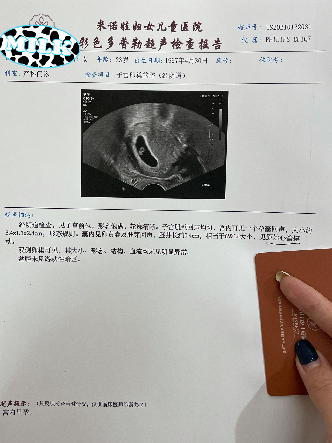 阴超