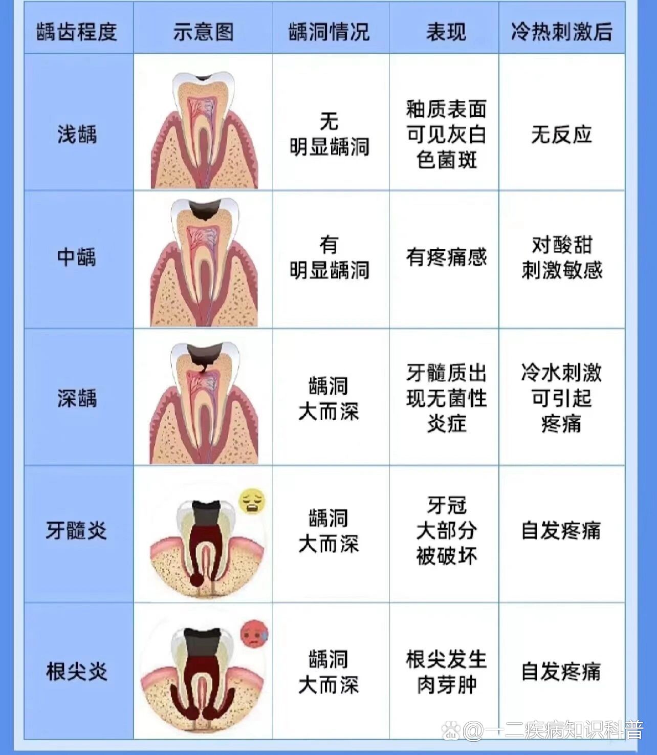 深龋去净腐质的标准图图片