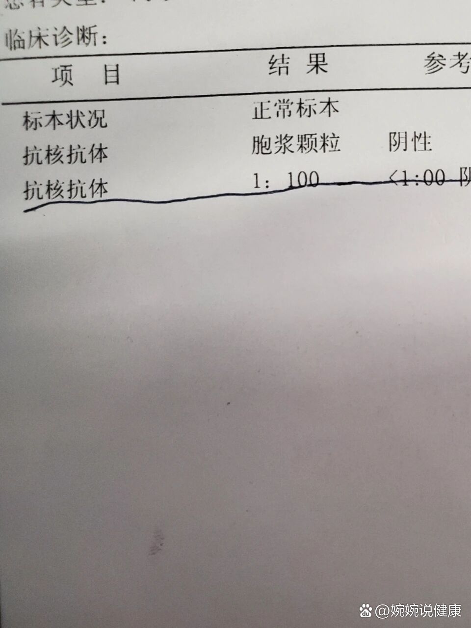 抗核抗体1:100,今天医生让做了乳酸脱氢酶,肌酸激酶,肌酸激酶同功酶