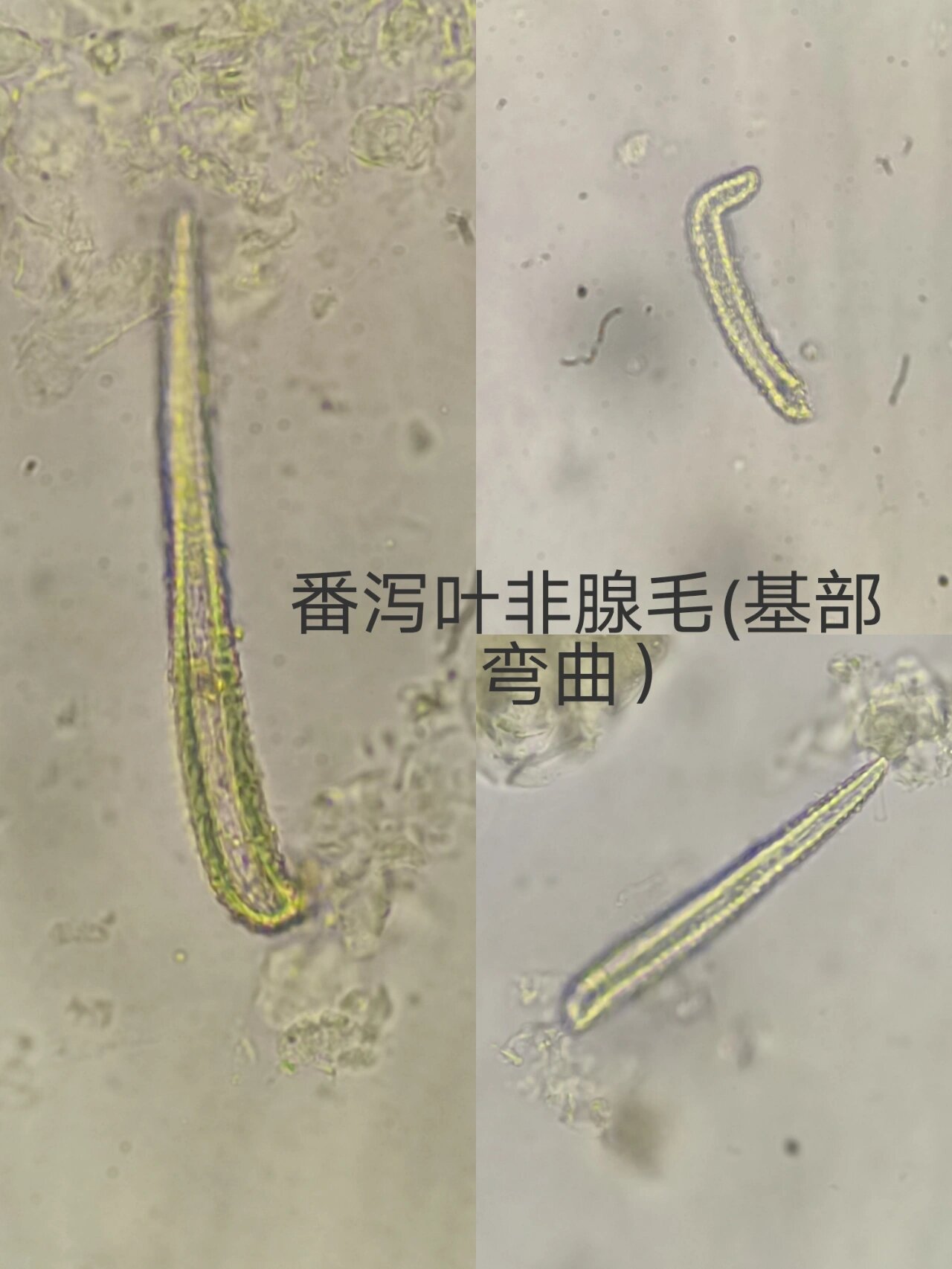 番泻叶粉末显微特征图