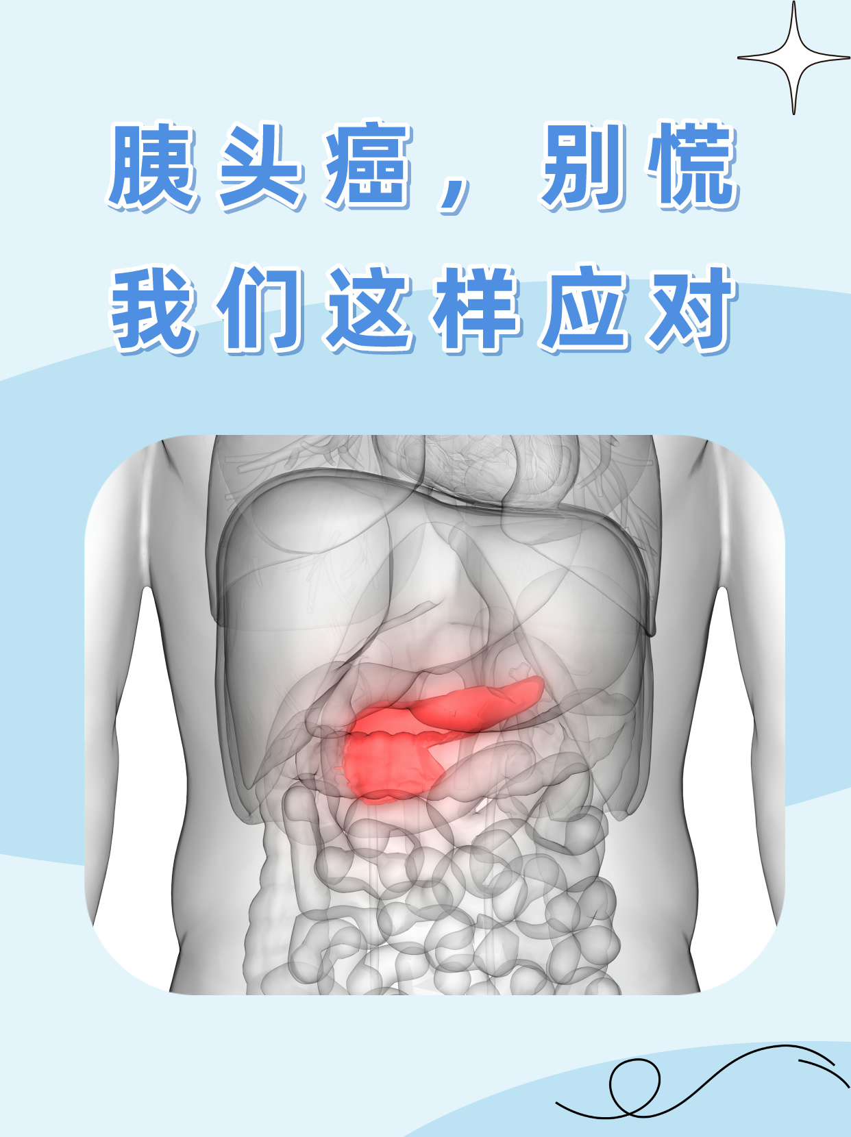 胰头癌,别慌!我们这样应对