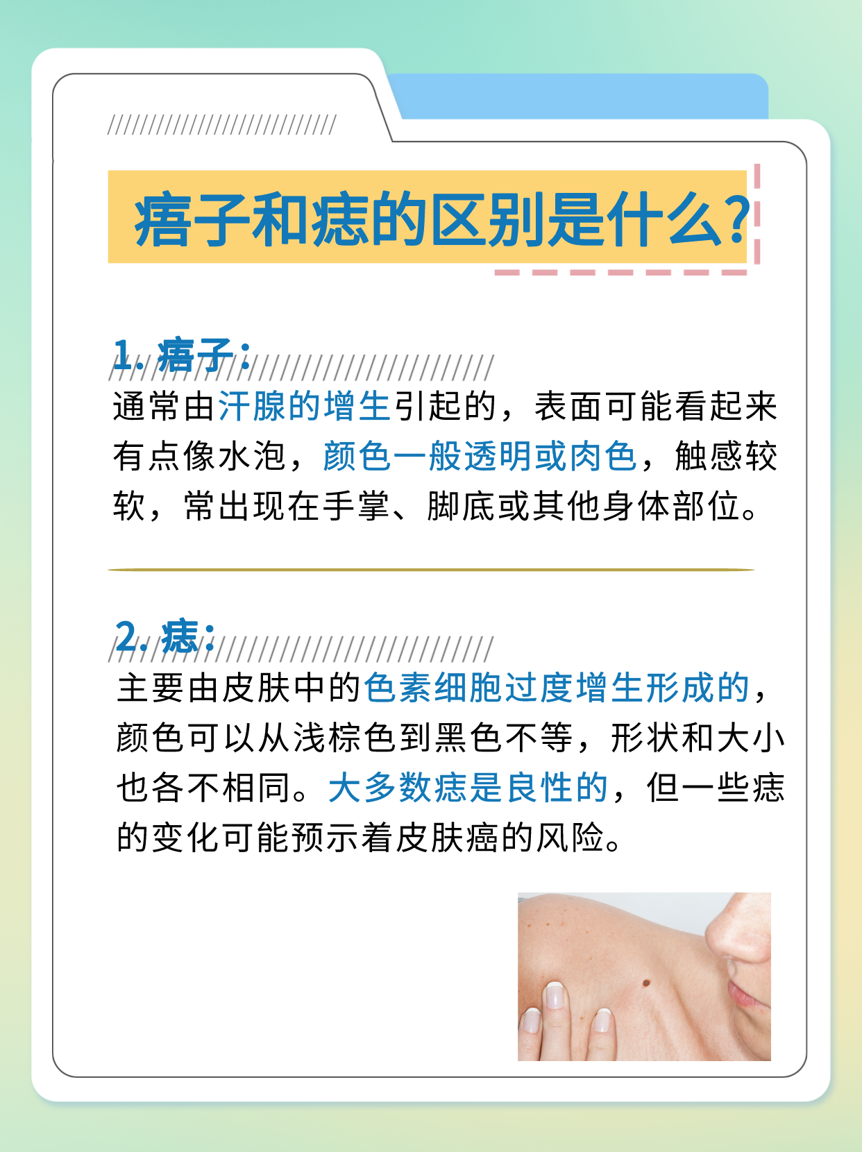 痦子还是痣?一文看懂区分技巧
