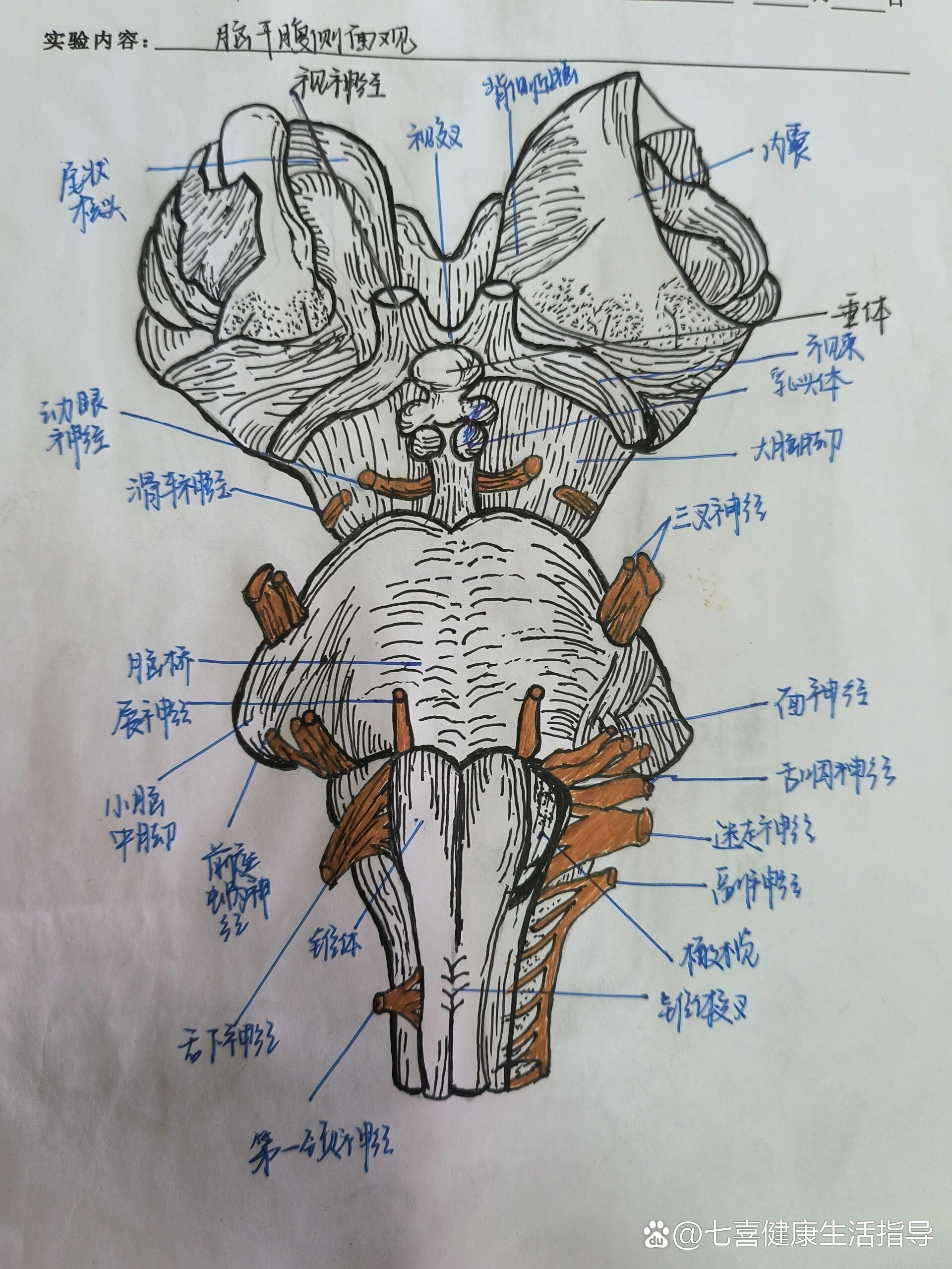 脑干示意图图片