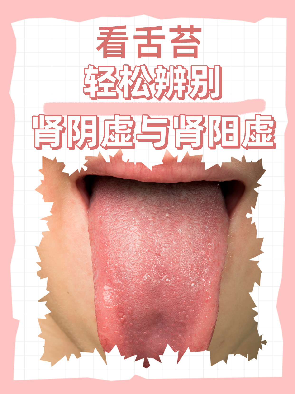 肾阴虚和肾阳虚怎么区分症状(肾阴虚和肾阳虚怎么区分症状表现)