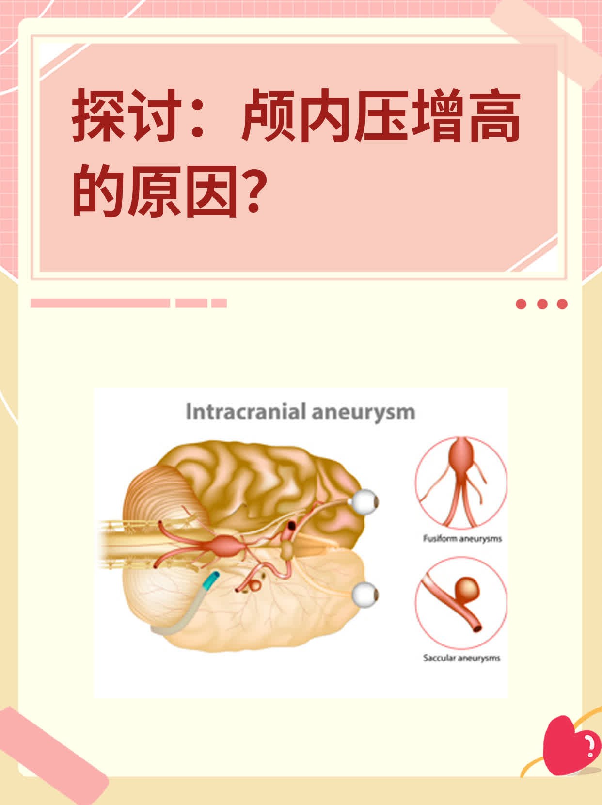 探讨:颅内压增高的原因