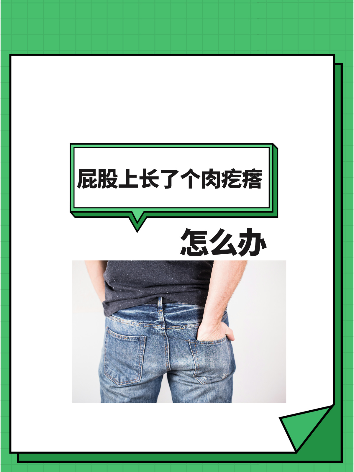 屁股上长了个肉疙瘩,怎么办?