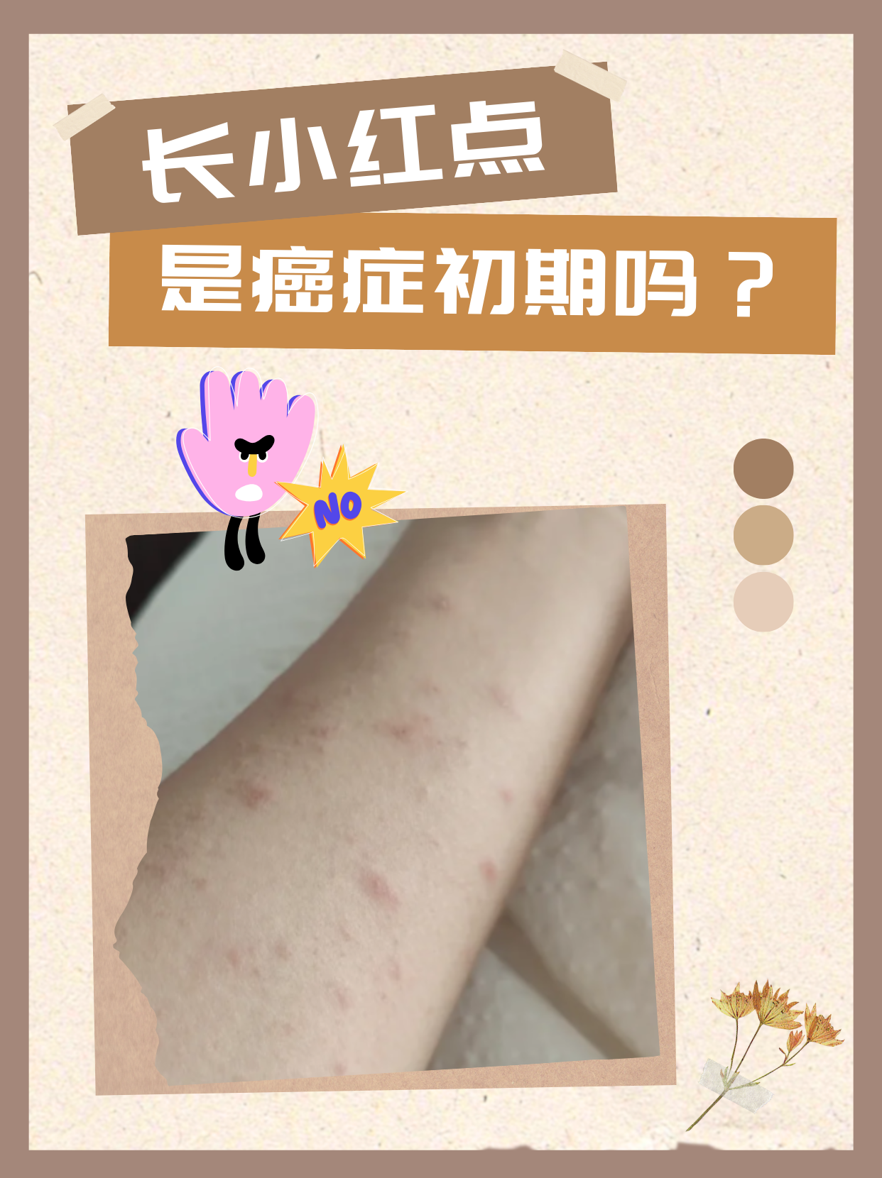 不舒服的感觉,上网查了一下有人说身上长红点可能是肝癌的早期症状,吓