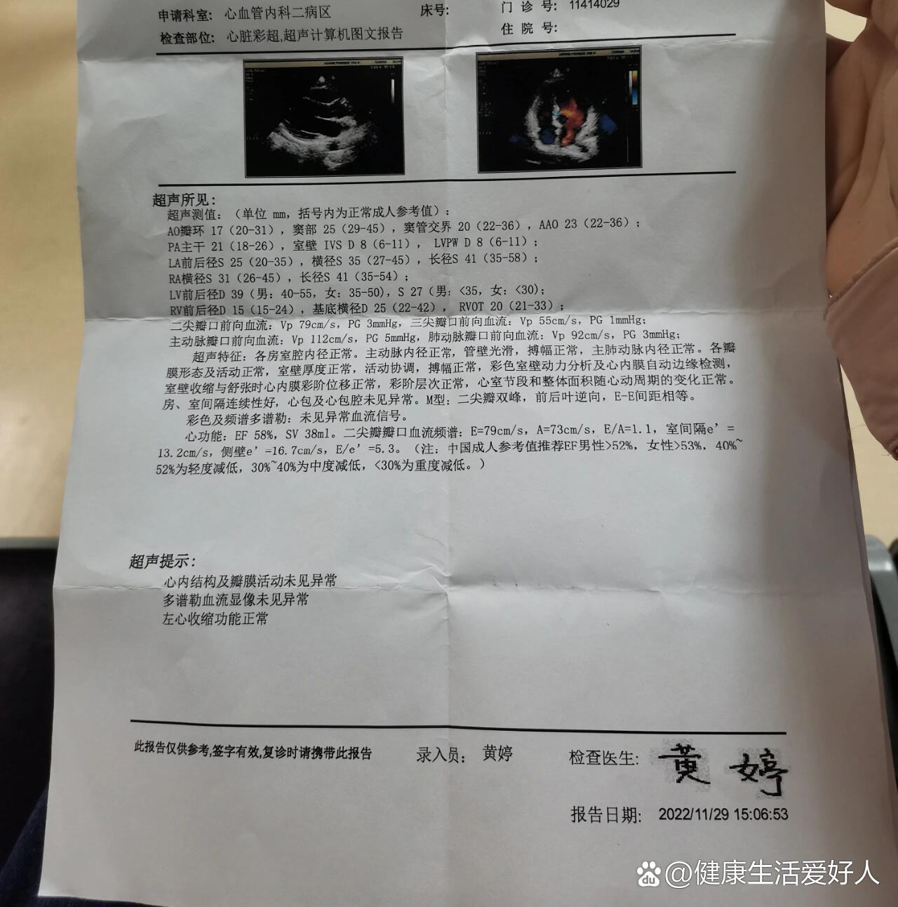 心悸