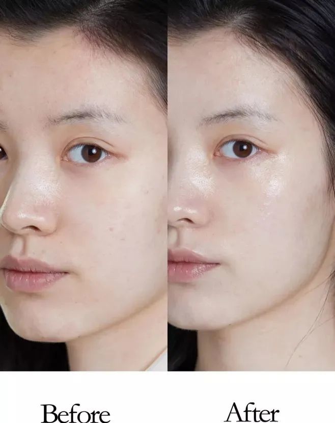 水光项目究竟是不是骗局?进来一起了解水光项目吧