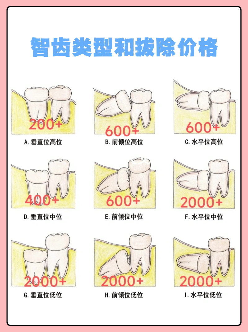 第三磨牙可以拔吗图片