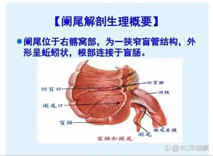 阑尾四层结构画图图片