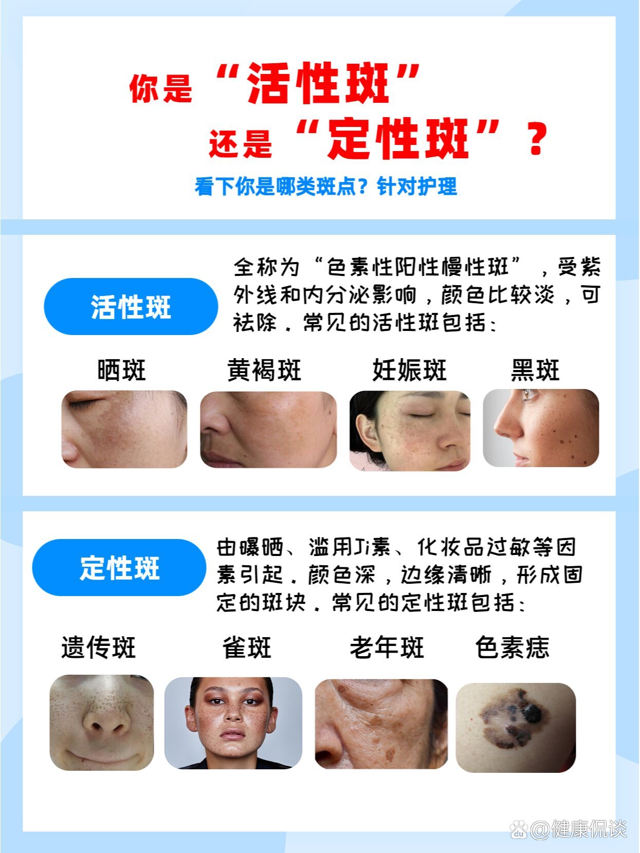 今天我来和大家分享一下这两种斑点的区别吧.