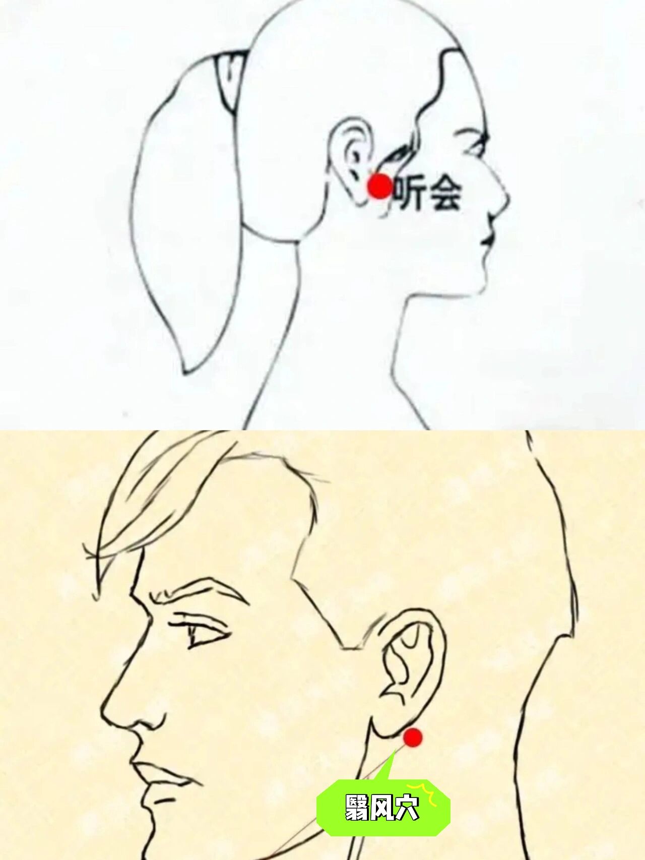 听会的准确按摩方法图片