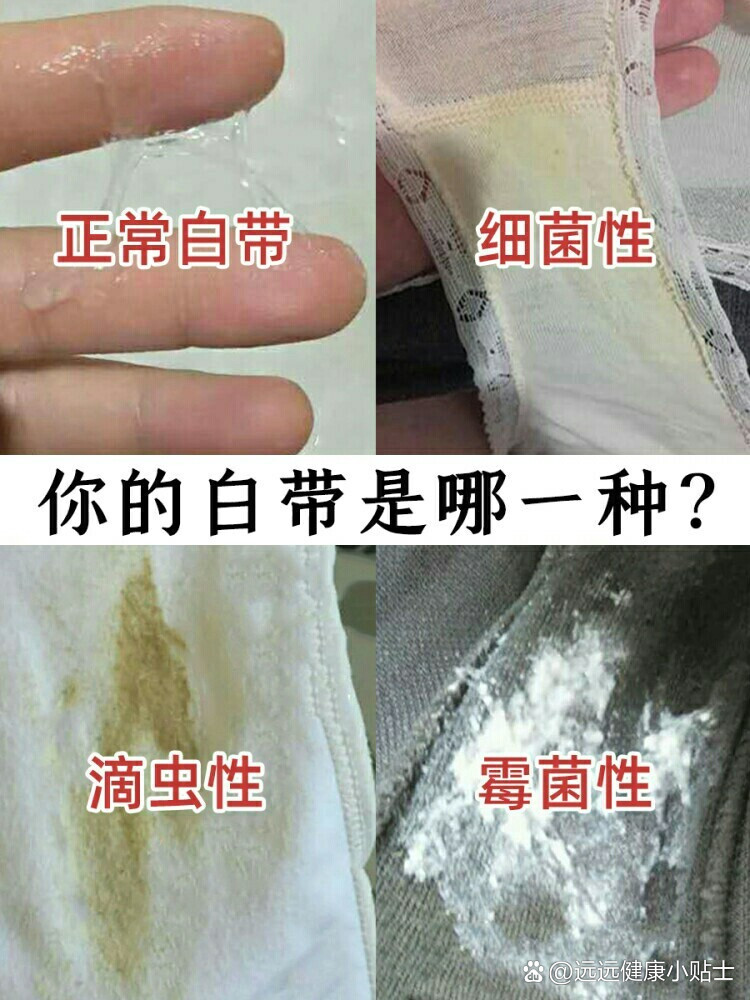 白带不正常怎么办图片