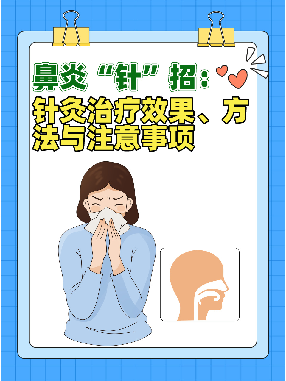 鼻炎"针"招:针灸治疗效果,方法与注意事项