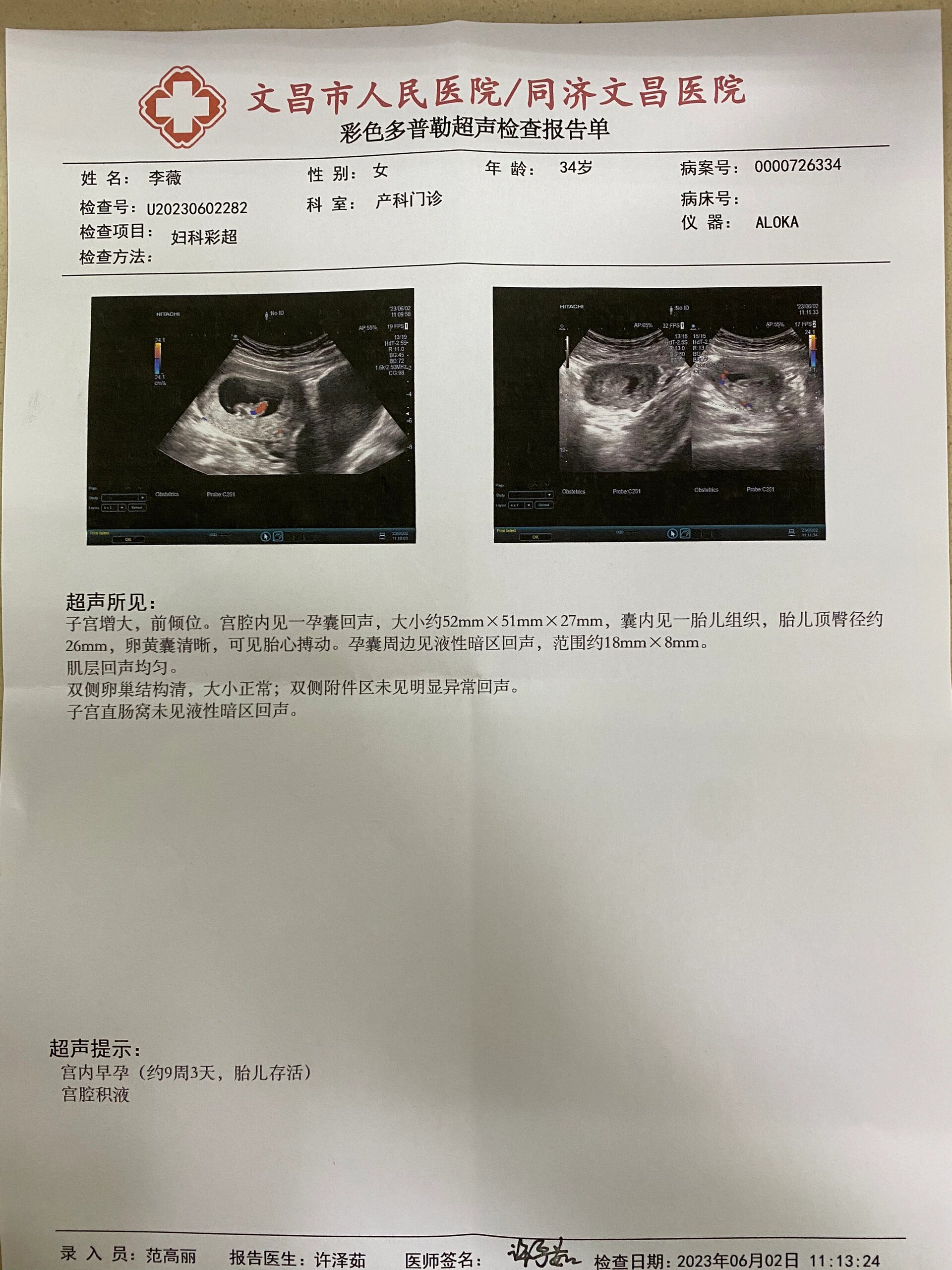 怀孕第一次b超有盆腔积液
