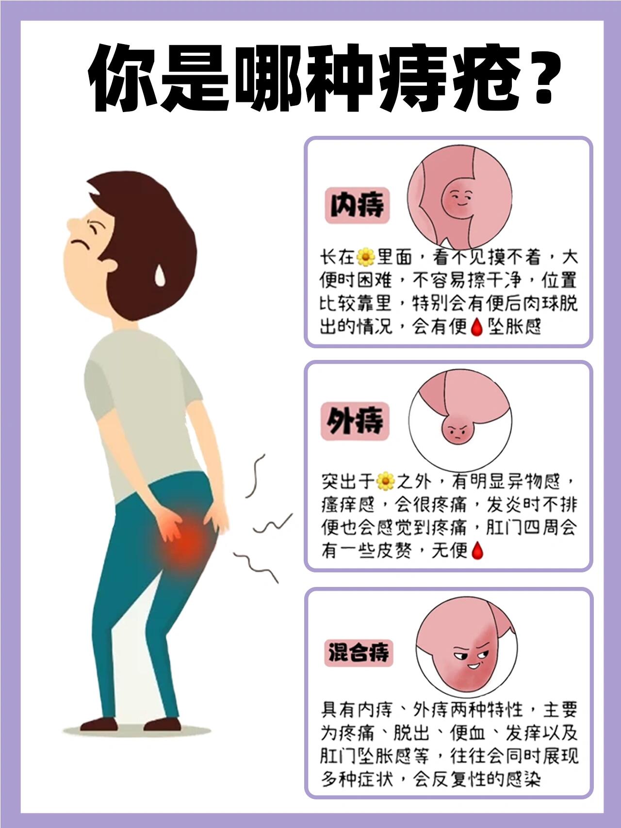 哨兵痔初期图片图片