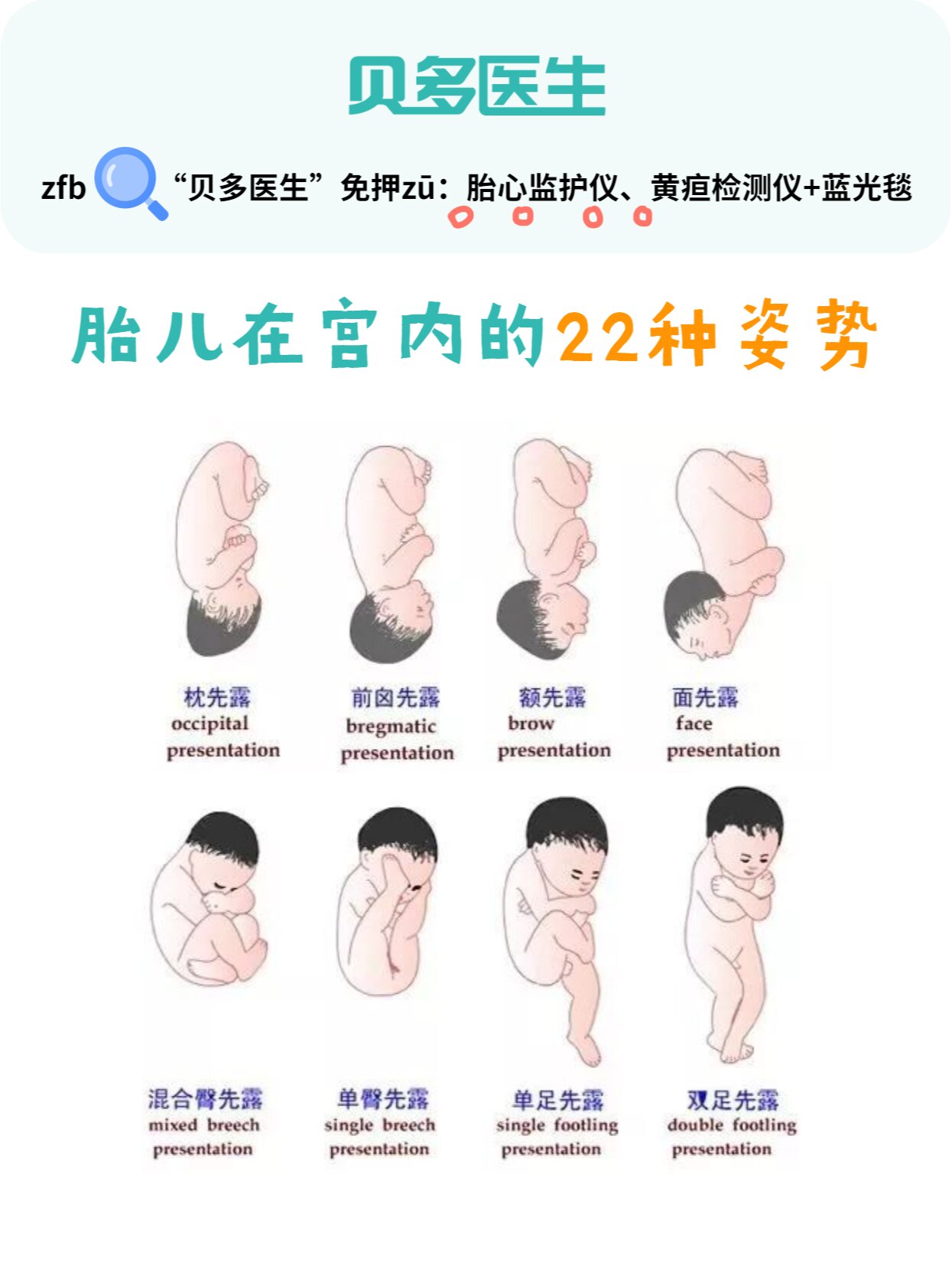 胎儿在子宫中到底有多少姿势?
