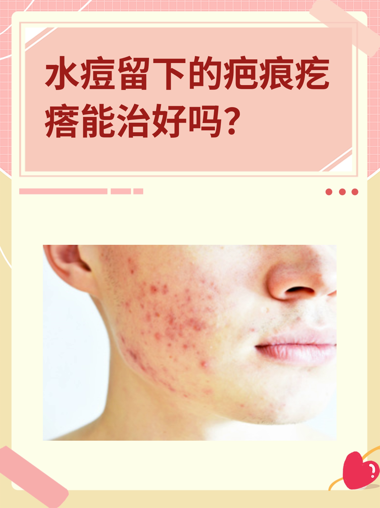 水痘留下的疤痕疙瘩能治好吗