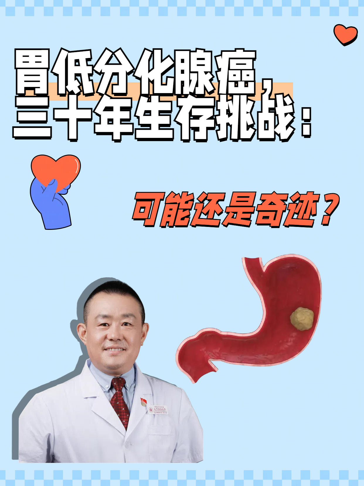 胃体小弯低分化腺癌图片