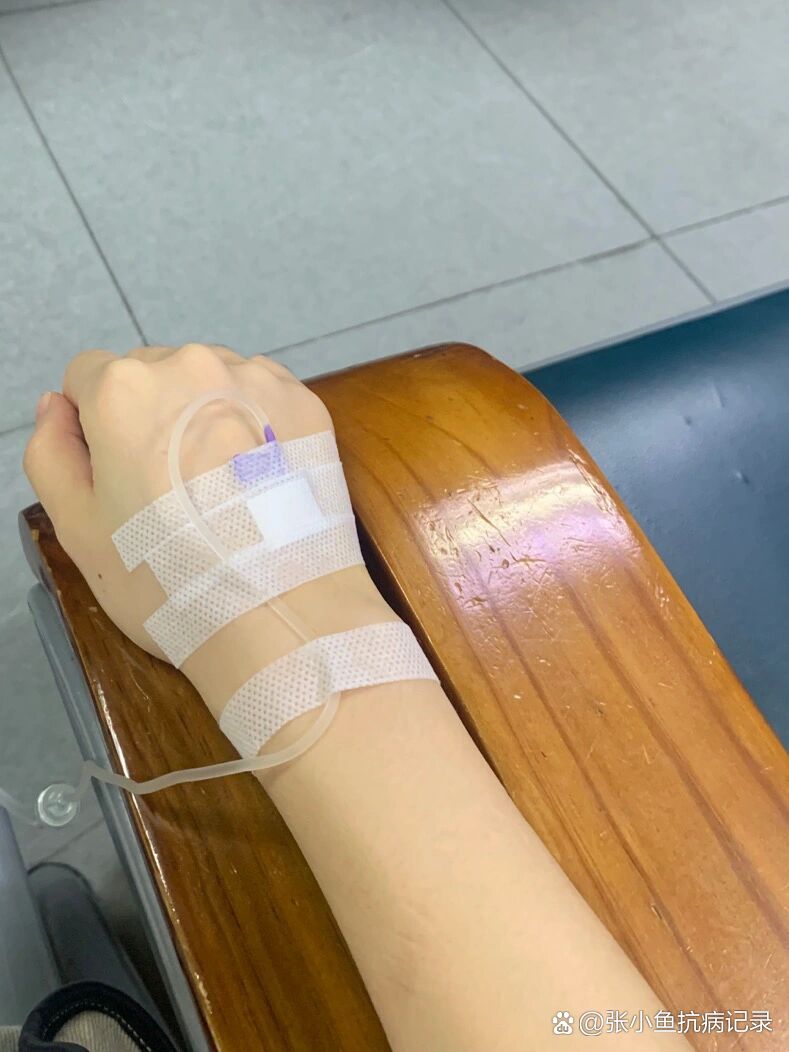 智齿发炎疼到打点滴!