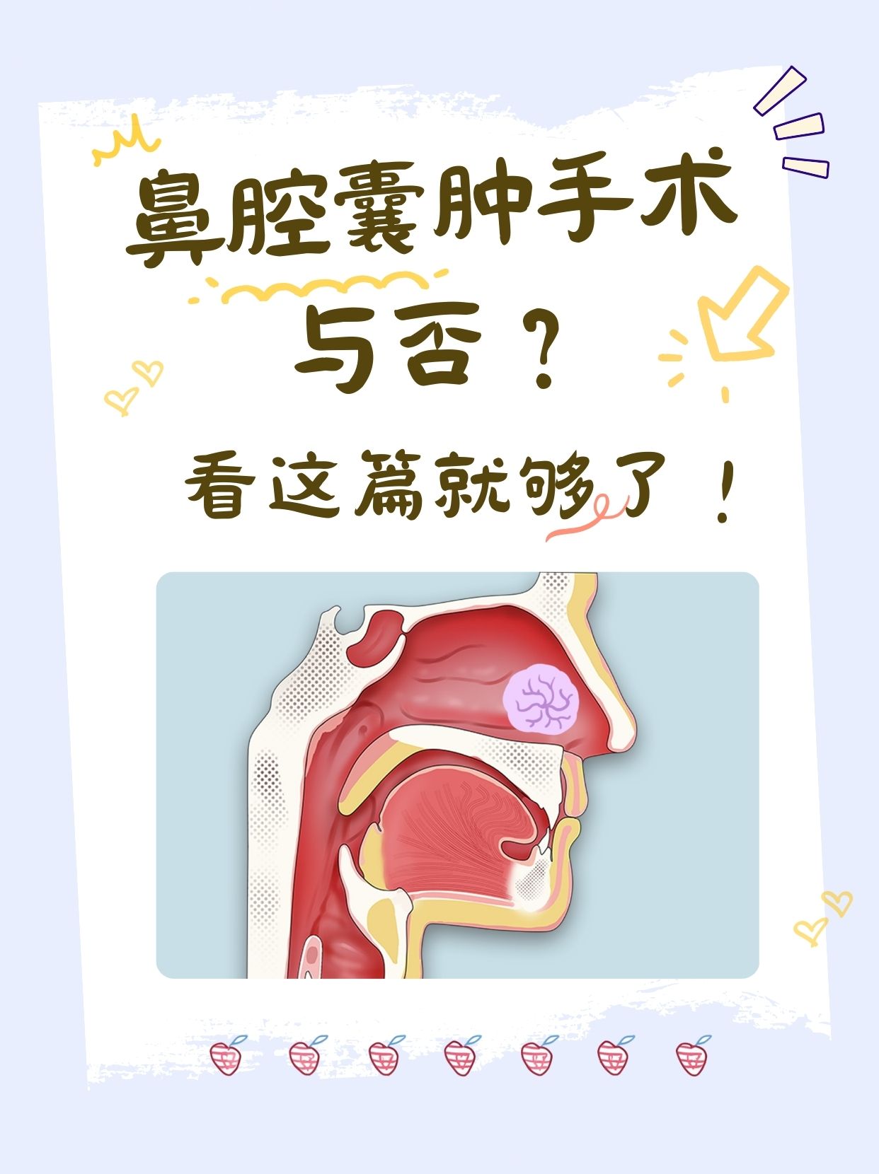 鼻腔囊肿怎么办?手术是必选项吗?