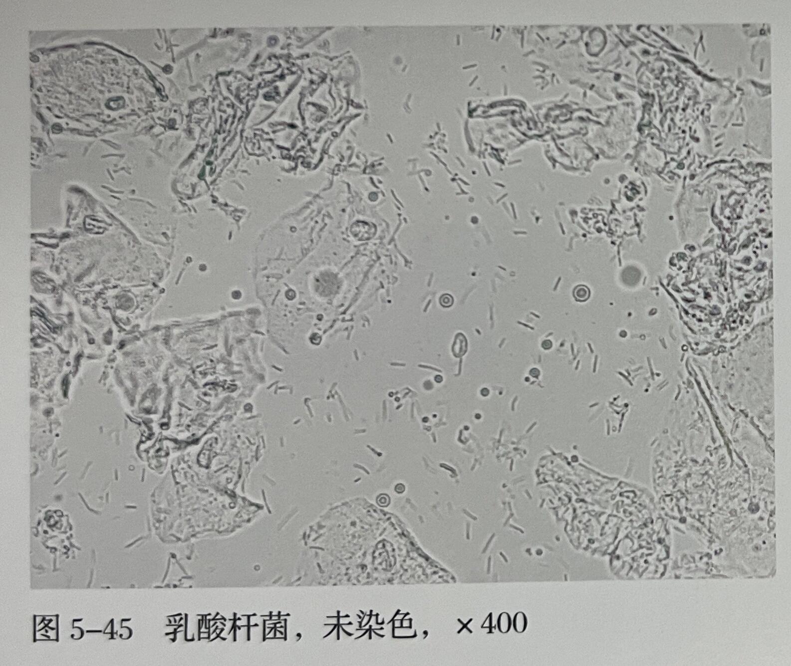 正常白带镜下图片大全图片