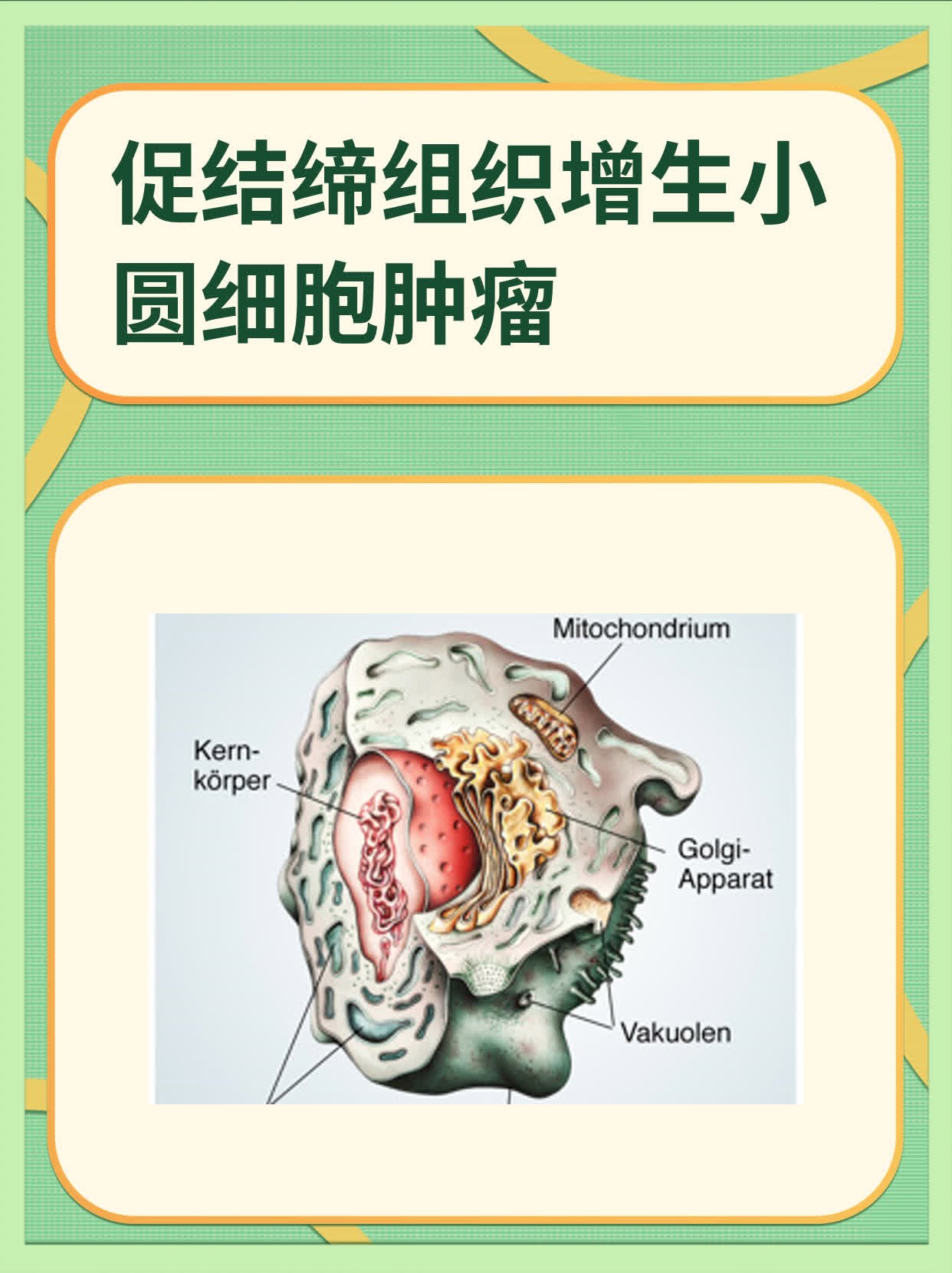 促结缔组织增生小圆细胞肿瘤